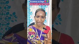 Eczema on legs🌺🍀#shorts #viral #trending #healthcare #eczema #skinproblem #itching #tamil#skinhealth