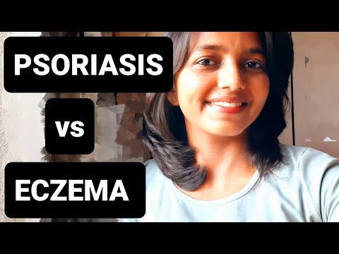 Video: Skillnaden Mellan Seborrheisk Dermatit Och Psoriasis