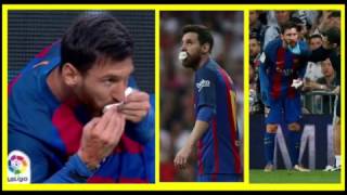 Real Madrid Vs Barcelona 23042017 Lionel Messi Bleeding