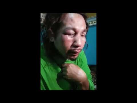 Akhirnya Bonyok .... Inilah orang yang telah menfitnah Habib Bahar dan mengaku HABAIB Akhirnya Bonyok .... Inilah orang yang telah menfitnah Habib Bahar dan mengaku HABAIB