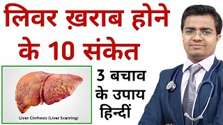 लिवर ख़राब होने के लक्षण | लिवर में सूजन के लक्षण और उपाय | Liver kharab hone ke Lakshan | Liver