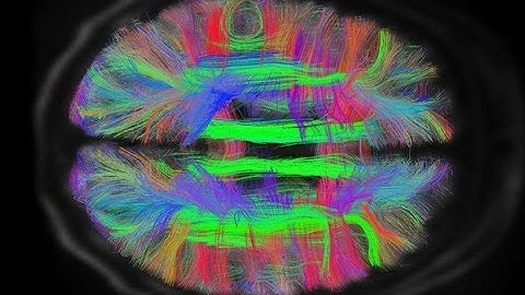 Uniglome - BCI headset for video gaming