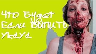 ЧТО БУДЕТ ЕСЛИ ВЫПИТЬ БУТЫЛКУ 70% УКСУСА? ЧТО БУДЕТ ЕСЛИ ВЫПИТЬ БУТЫЛКУ 70% УКСУСА?
