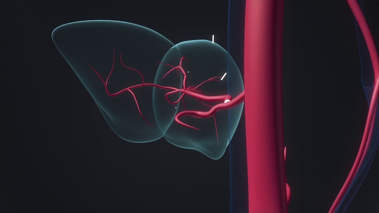 Applications For Regional Chemotherapy - 