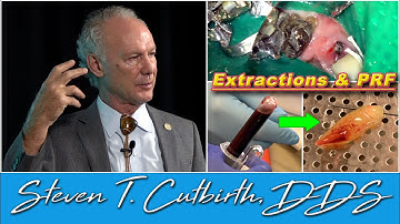 Teeth Extractions and PRF Bone Grafting - Dental Minute with Steven T. Cutbirth, DDS
