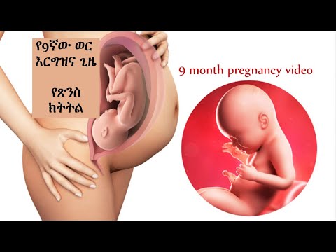 ቪዲዮ: ሰዶማዊት ማለት የቃሉ አመጣጥ ትርጉም እና ታሪክ ነው።