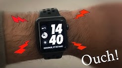 Apple Watch causing wrist pain ? Should you return it? (SOLVED)