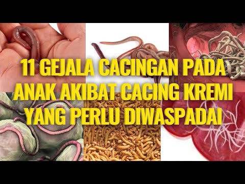 Video: Cacing Kremi Pada Kanak-kanak: Gejala