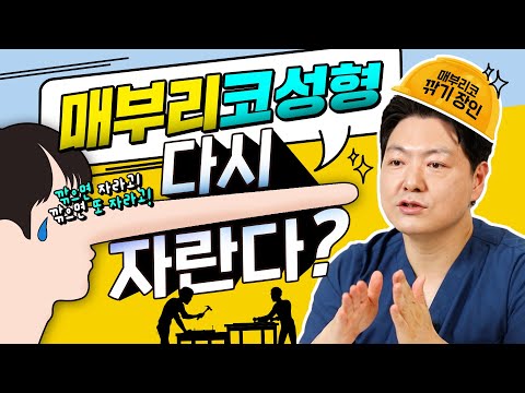 매부리코 수술해도 다시 자란다고? 진실 혹은 거짓