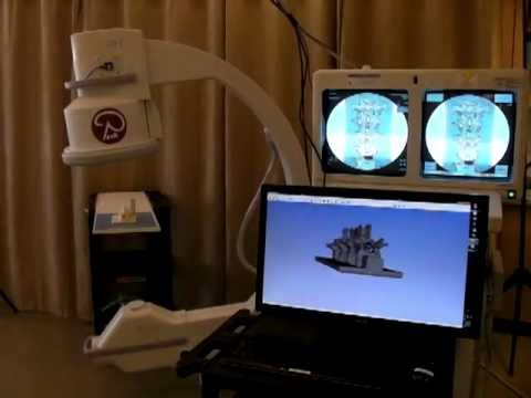 C-arm tracking using an accelerometer