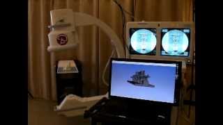 C-arm tracking using an accelerometer
