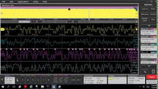 Automotive Ethernet PAM3 and Signal Separation Introduction