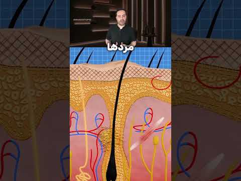 علت ریزش مو در آقایان