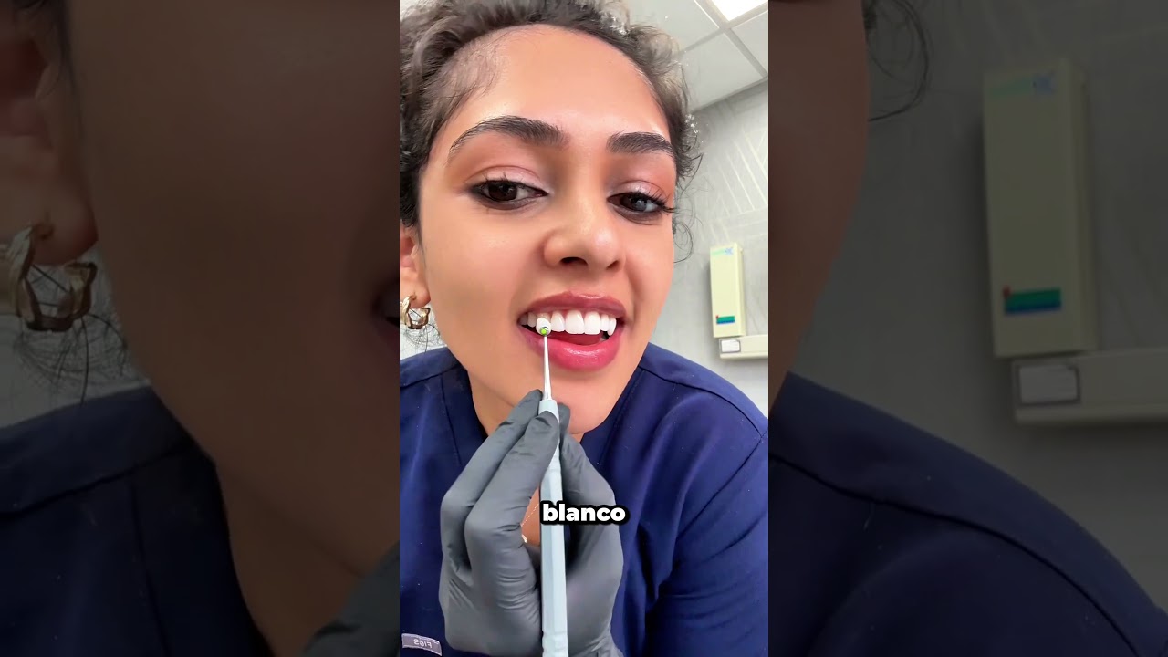 Dentista revela el truco del empaste perfecto