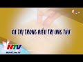 XẠ TRỊ TRONG ĐIỀU TRỊ UNG THƯ