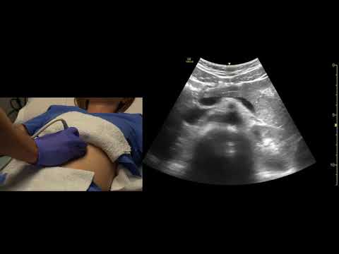 Pancreas, Scanning Technique