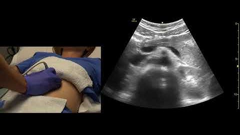 Pancreas, Scanning Technique