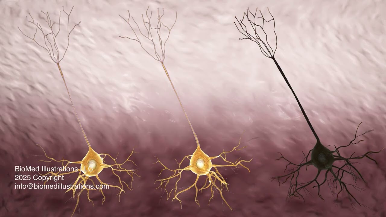 Operating Room Accident Reenactment with Brain Trauma (Medical-Legal Case)