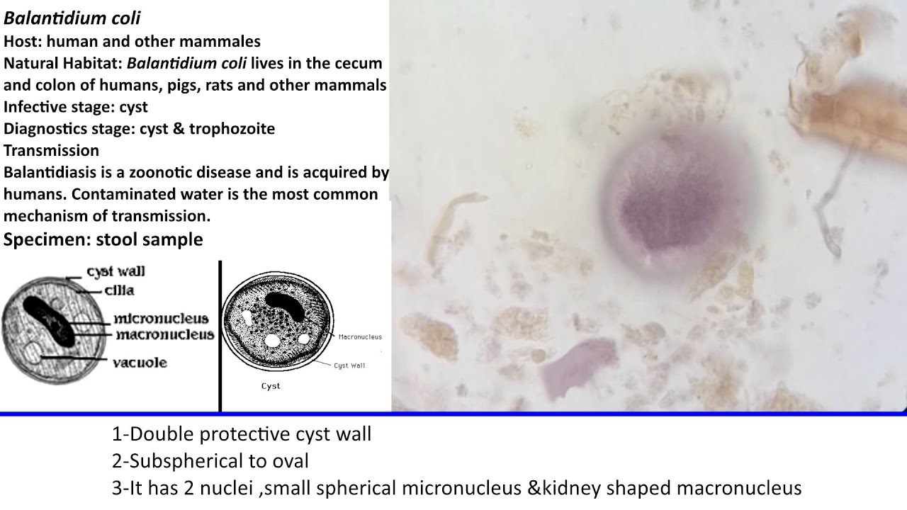 Balantidium Coli Cyst Form escherichia-coli-tsh-genetic-pcr-solutions