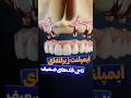 ایمپلنت زیر لثه ای ناجی فک های ضعیف