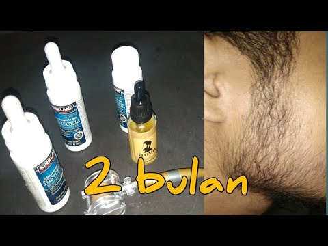 Como aplicar el minoxidil en la cabeza