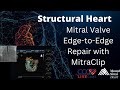 Mitral Valve Edge-to-Edge Repair with MitraClip - Structural Live May 2017