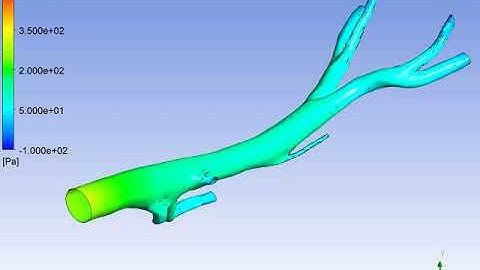 pressure distribution : Aorta, Non-Newtonian pulsating blood flow, ANSYS Fluent Simulation Training