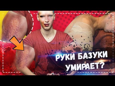 Руки базуки, что с ним? / Кирилл Терешин умирает