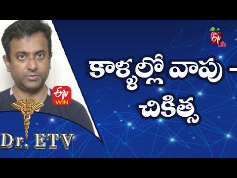 Leg Swelling - Cause and Treatment | కాళ్ళల్లో వాపు - చికిత్స | Dr.ETV | 5th August 2021 | ETV Life