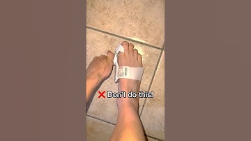 How to get rid of bunions… ￼#bunions #footpain