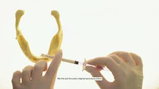 How to Use 4MATRIX+ Bone Graft Putty How To Mix Socket Graft Putty