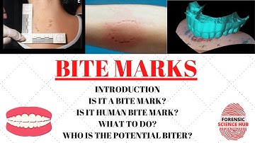 Bite marks | Forensic odontology | UGC NET Forensic science