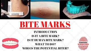 Celebrity Bite marks | Forensic odontology | UGC NET Forensic science Wealth