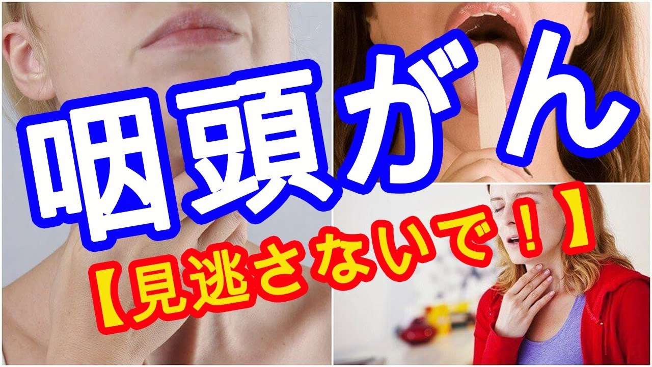 オススメ 見逃さないで 咽頭がんの8つの初期症状 健康寿命 喉が痛い時に見るサイト