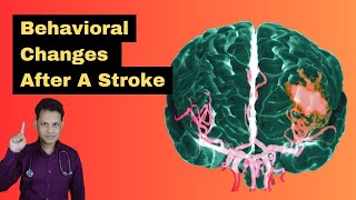 Unveiling The Surprising Effects Of A Brain Stroke On Behavior