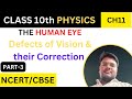 Defects of Vision and their Correction|PART-3|CLASS10 SCIENCE CBSE/NCERT|