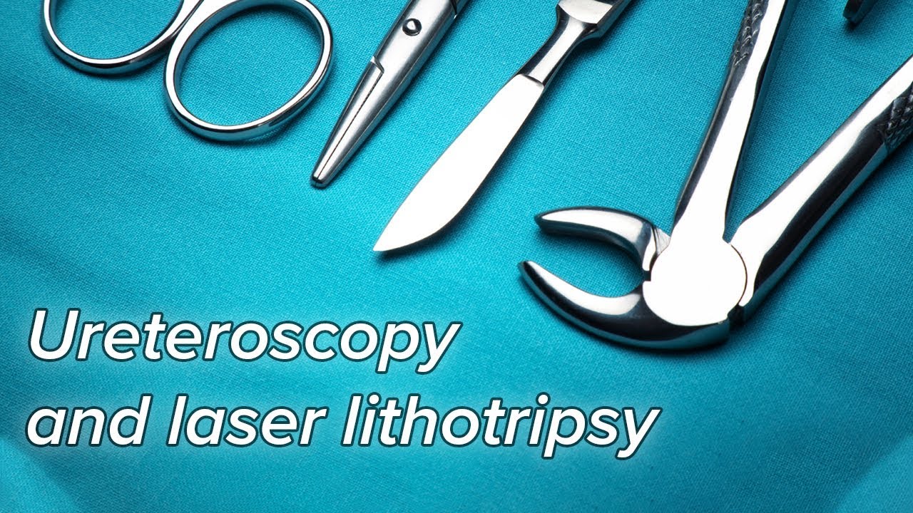 Ureteroscopy and laser lithotripsy Surgical Procedures YouTube