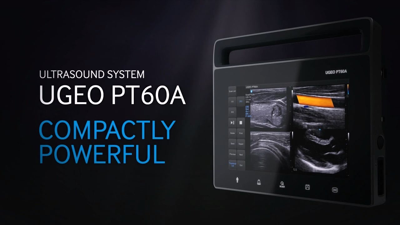 Samsung Medison PT60A