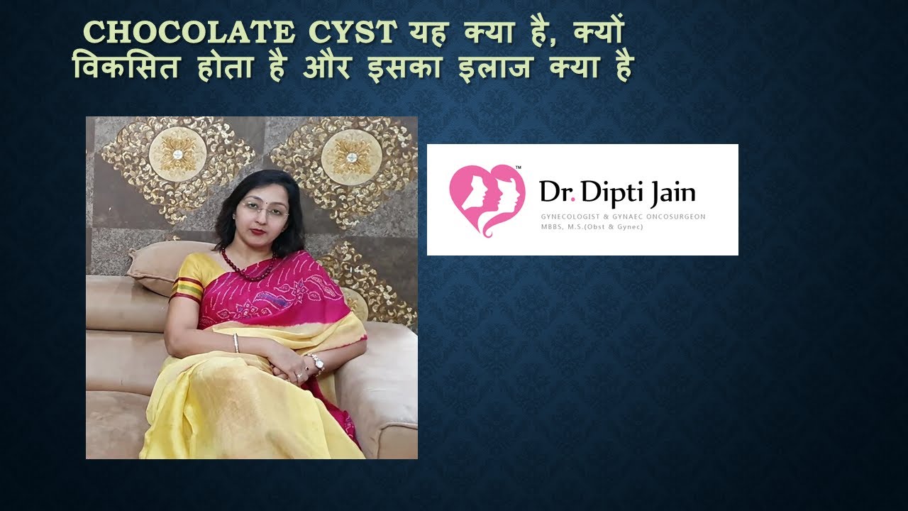 Chocolate Cyst चॉक्लेट सिस्ट क्या होती है ,क्या है इसका बेस्ट इलाज