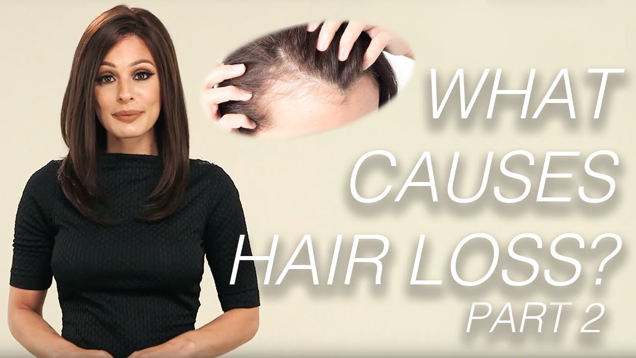 Part 2 Causes of Hair Loss Wigs 101 YouTube