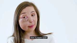 Details Face Equality 2018 - Young Champions with Visible Differences - #ProudToBeMe Update