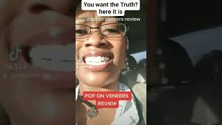 Pop On Veneers The Truth.. Full. Video On My Channel