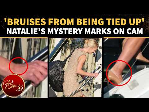 Natalie Harp’s STRANGE Wrist & Ankle Marks Catch Attention; Trump Aide’s Latest Viz BAFFLE Critics