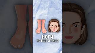 Варикоз или отек? #варикоз #отек #здоровье #здоровьеног #ноги #лечение #лечениеварикоза #клиника