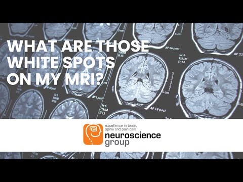 What are the white spots on my MRI?