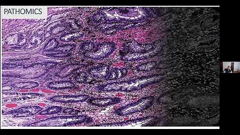 Artificial Intelligence and Computational Patholog...