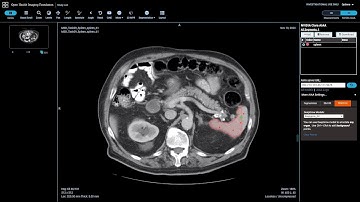 What’s New in Clara Train 4.0