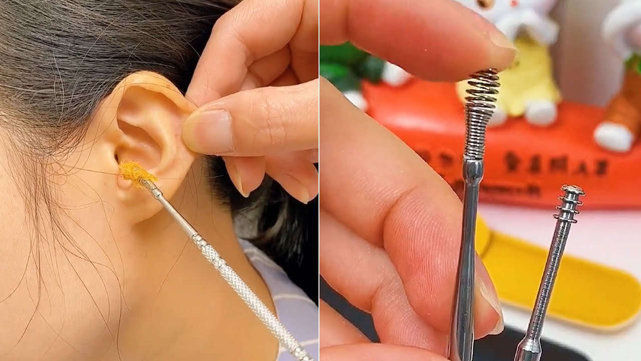 Best Earwax Removal Videos