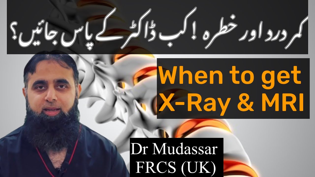 Red Flags for Back pain | when to start worry | Do we really need X-RAY and MRI for back pain