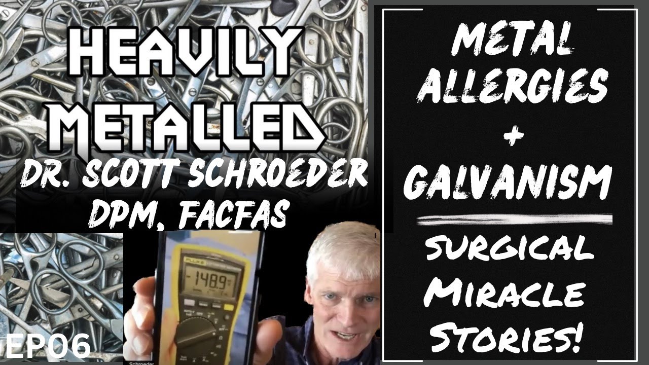 EP06  Miraculous Surgical Cases, Metal Allergies and Galvanism with Dr. Scott Schroeder, DPM, FACFAS